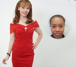 Lần đầu tôi kể số 4| Chia nụ cười sẻ cảm thông – Đổi thay số phận cho người con hiếu thảo